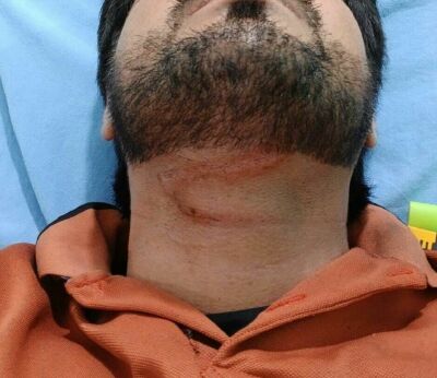 Imagem da notícia Fio de internet derruba e enforca motoentregador em Chapadão do Sul